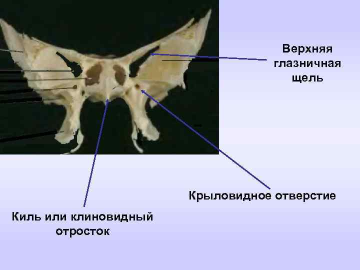 Клиновидная кость фото картинка