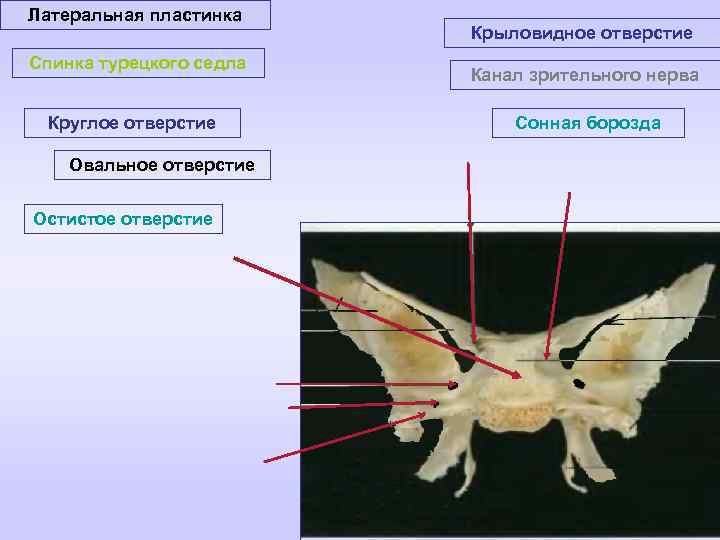 Латеральная пластинка Спинка турецкого седла Круглое отверстие Овальное отверстие Остистое отверстие Крыловидное отверстие Канал