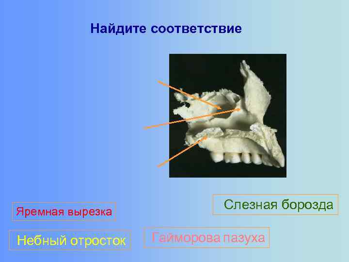 Найдите соответствие Яремная вырезка Небный отросток Слезная борозда Гайморова пазуха 