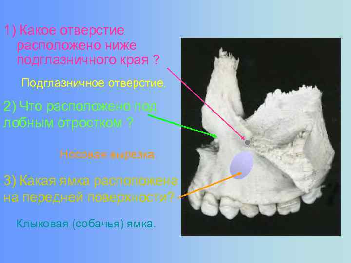 1) Какое отверстие расположено ниже подглазничного края ? Подглазничное отверстие. 2) Что расположено под