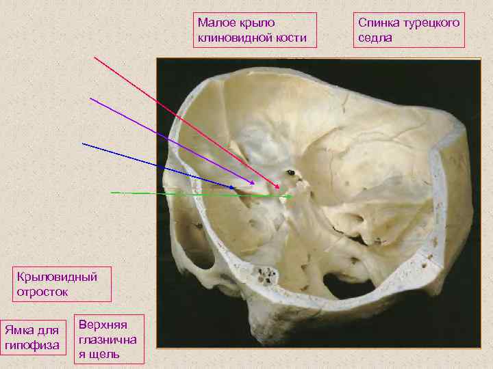 Малое крыло клиновидной кости Крыловидный отросток Ямка для гипофиза Верхняя глазнична я щель Спинка