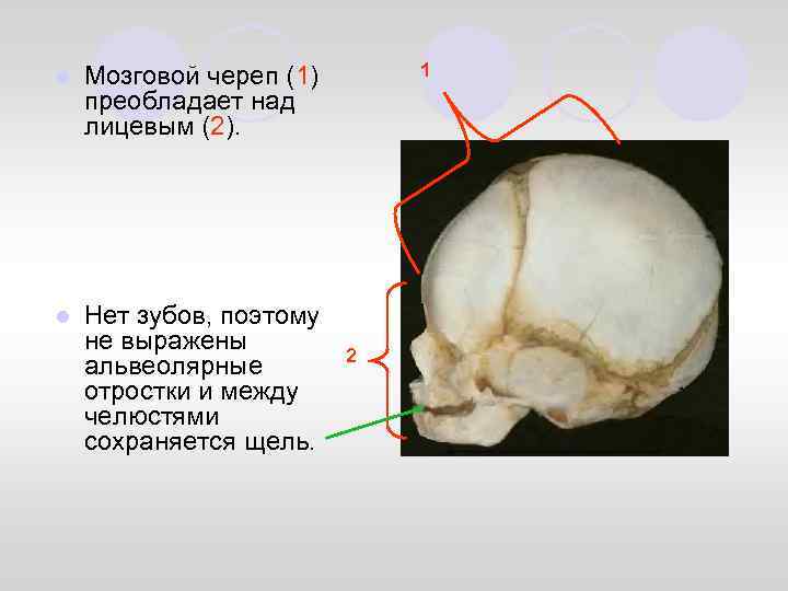 l l Нет зубов, поэтому не выражены альвеолярные отростки и между челюстями сохраняется щель.
