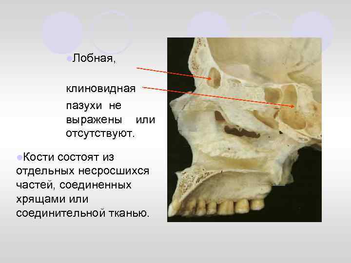 Основная кость. Клиновидная пазуха клиновидной кости. Клиновидная пазуха анатомия на кости. Воздухоносная полость клиновидной кости. Носовые пазухи клиновидной.