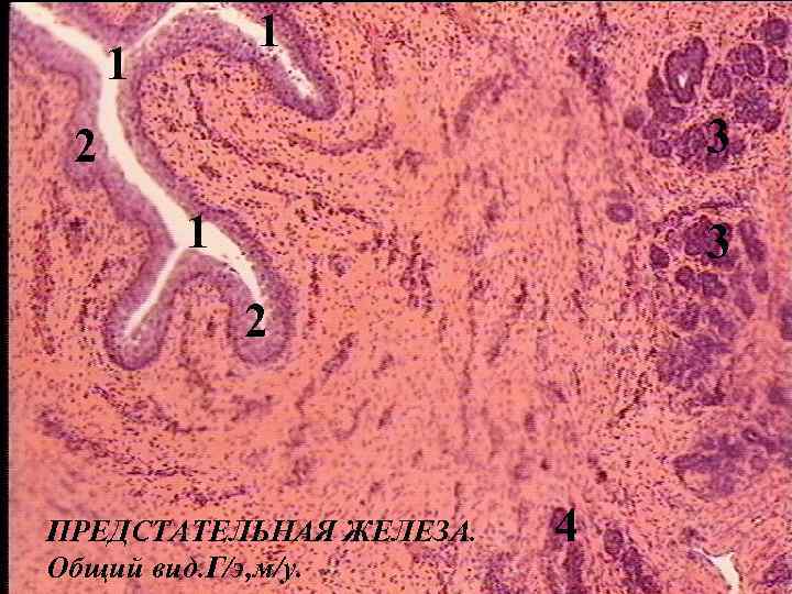 1 1 3 2 ПРЕДСТАТЕЛЬНАЯ ЖЕЛЕЗА. Общий вид. Г/э, м/у. 4 
