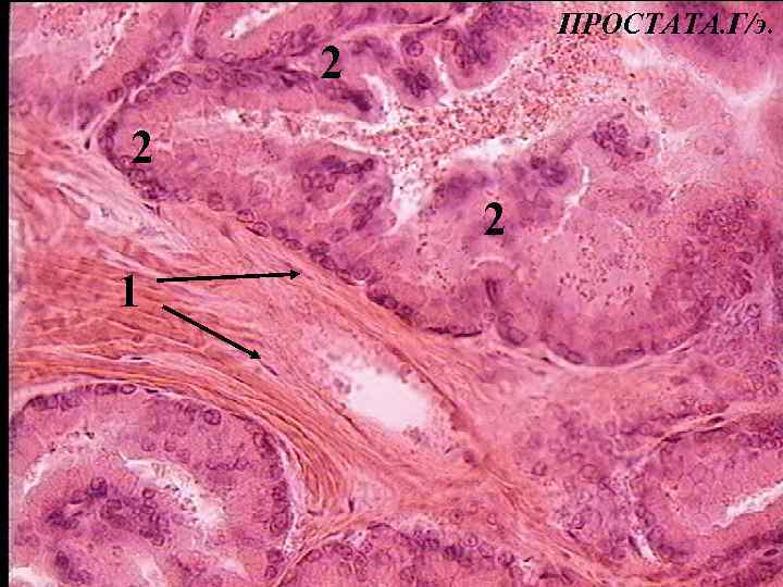 ПРОСТАТА. Г/э. 2 2 2 1 