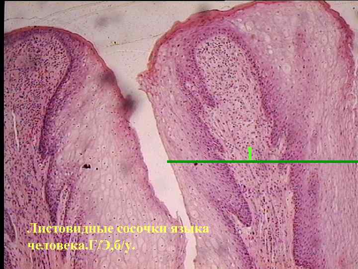 1 Листовидные сосочки языка человека. Г/Э, б/у. 