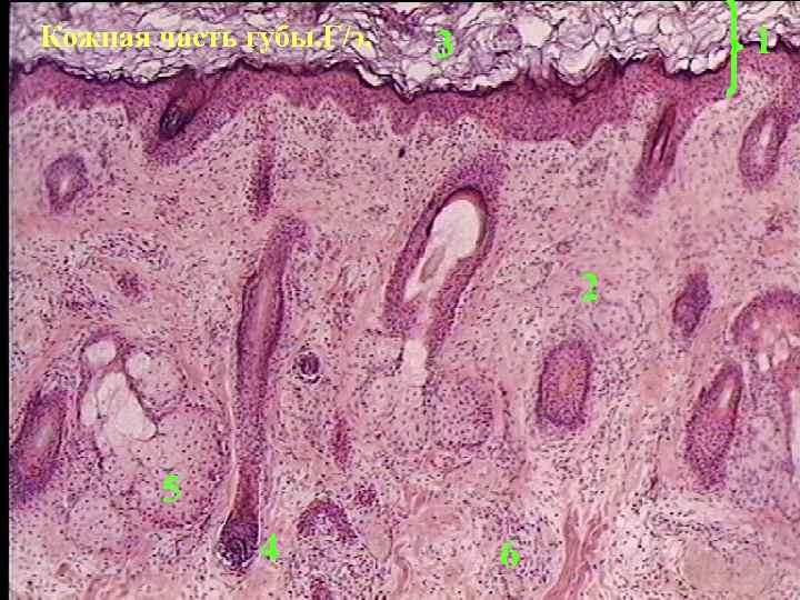 Кожная часть губы. Г/э. 1 3 2 5 4 6 