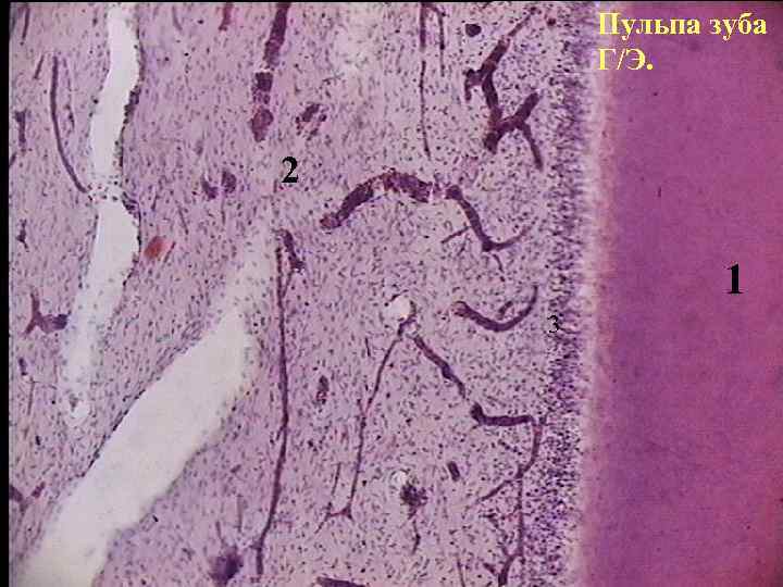 Пульпа зуба Г/Э. 2 1 3 