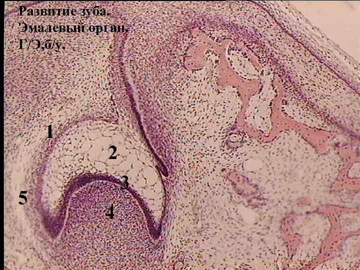 Развитие зуба. Эмалевый орган. Г/Э, б/у. 1 5 2 3 4 