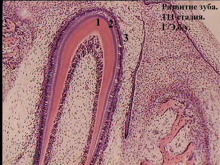 Зубная ткань. Гистогенез зуба гистология. Гистогенез зуба гистология препарат. Дентин препарат гистология. Поздняя стадия развития зуба. Гистогенез дентина..