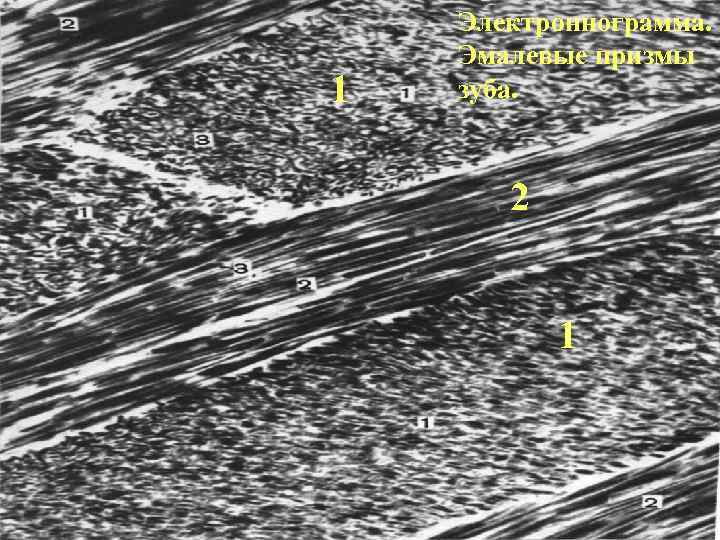1 Электроннограмма. Эмалевые призмы зуба. 2 1 