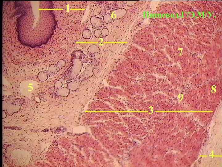 1 6 Пищевод. Г/Э, М/У. 2 7 5 9 8 3 4 
