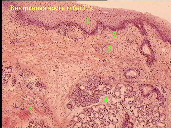Внутренняя часть губы. Г/э. 1 2 3 4 5 