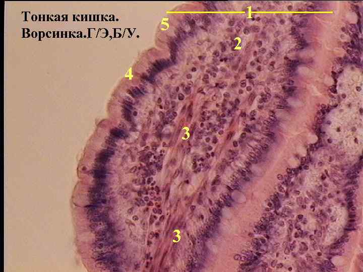 Кишечные ворсинки фото