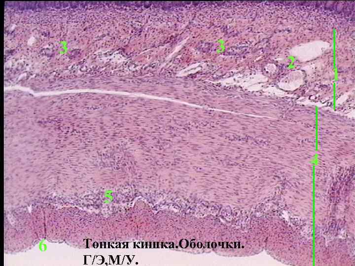 3 3 2 1 4 5 6 Тонкая кишка. Оболочки. Г/Э, М/У. 