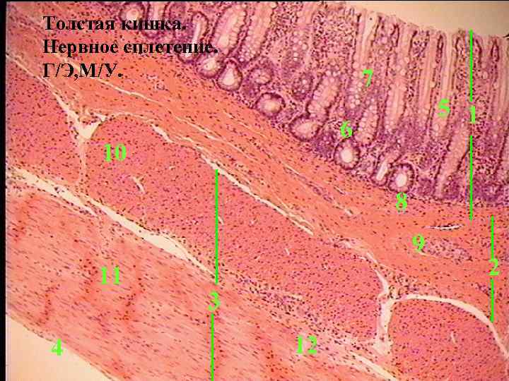 Толстая кишка. Нервное сплетение. Г/Э, М/У. 7 5 1 6 10 8 9 11
