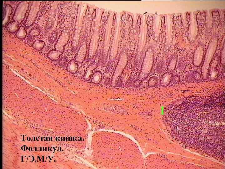 Толстая кишка рисунок гистология