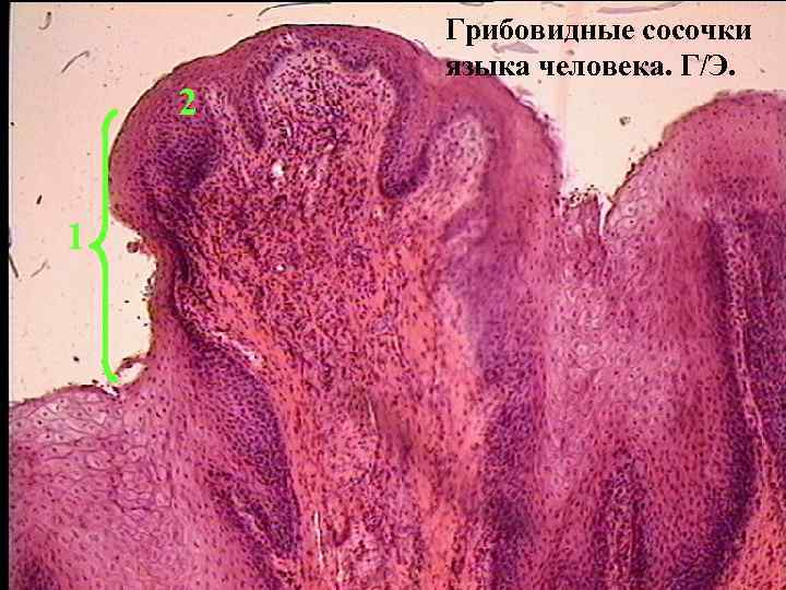 Желобовидный сосочек языка фото