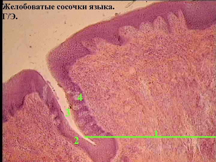 Желобоватые сосочки языка. Г/Э. 4 3 2 1 