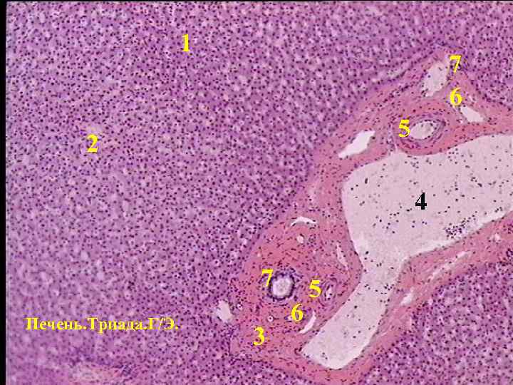 1 7 6 5 2 4 7 Печень. Триада. Г/Э. 3 6 5 