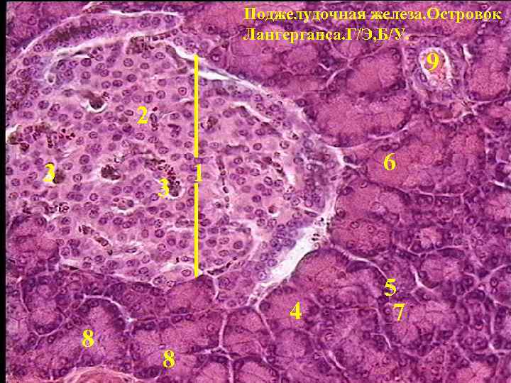 Поджелудочная железа. Островок Лангерганса. Г/Э, Б/У. 9 2 3 3 8 6 1 4