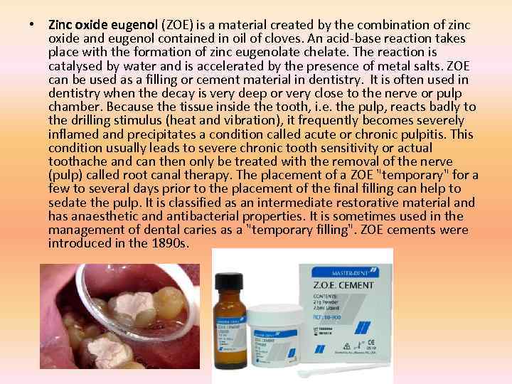  • Zinc oxide eugenol (ZOE) is a material created by the combination of