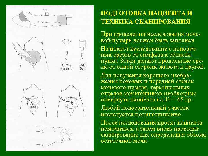 ПОДГОТОВКА ПАЦИЕНТА И ТЕХНИКА СКАНИРОВАНИЯ При проведении исследования мочевой пузырь должен быть заполнен. Начинают
