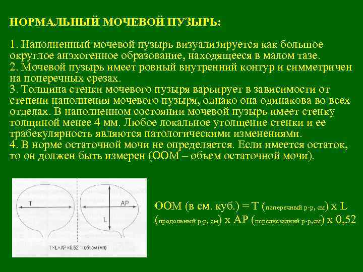 НОРМАЛЬНЫЙ МОЧЕВОЙ ПУЗЫРЬ: 1. Наполненный мочевой пузырь визуализируется как большое округлое анэхогенное образование, находящееся