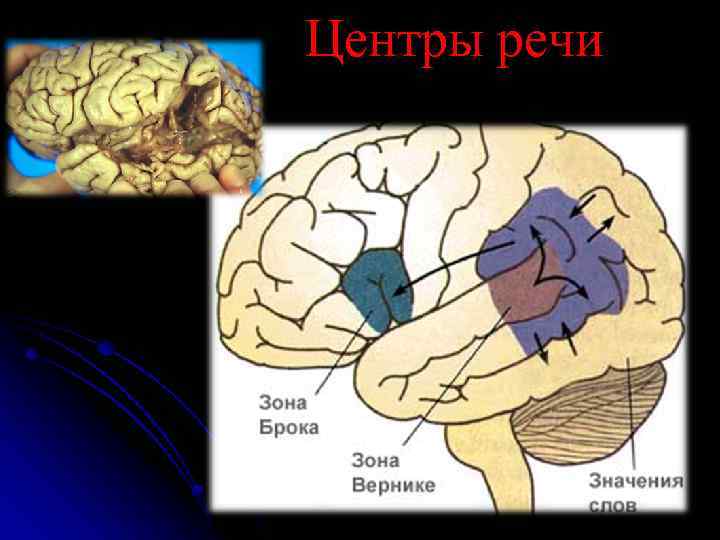 Речевой центр находится. Зоны головного мозга Брока и Вернике. Центры речи. Поля Брока в головном мозге. Центры речи кратко.