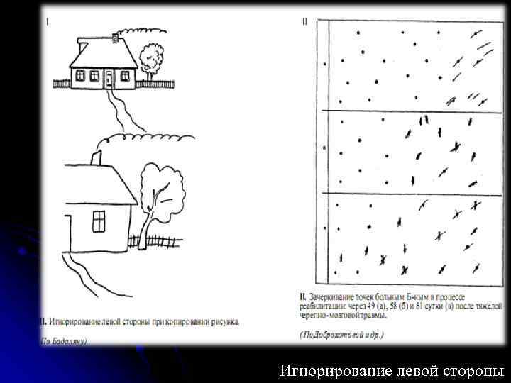 Игнорирование левой стороны 