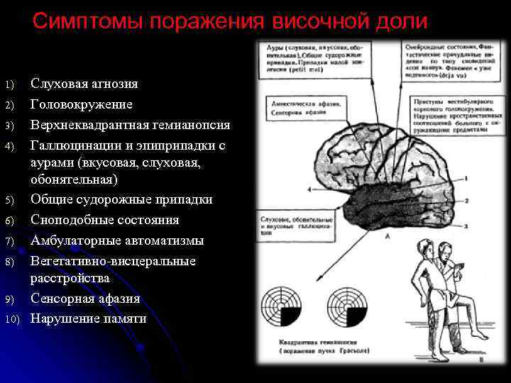 Височной извилины