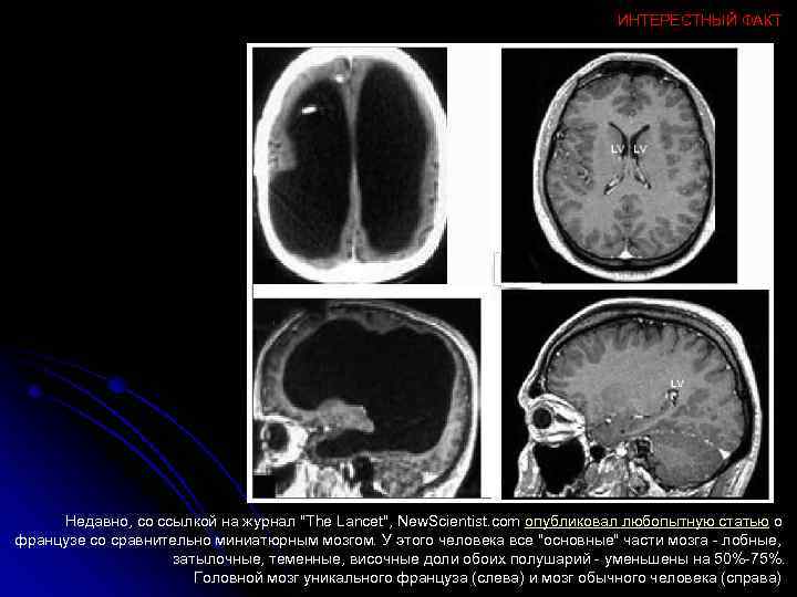 ИНТЕРЕСТНЫЙ ФАКТ Недавно, со ссылкой на журнал "The Lancet", New. Scientist. com опубликовал любопытную