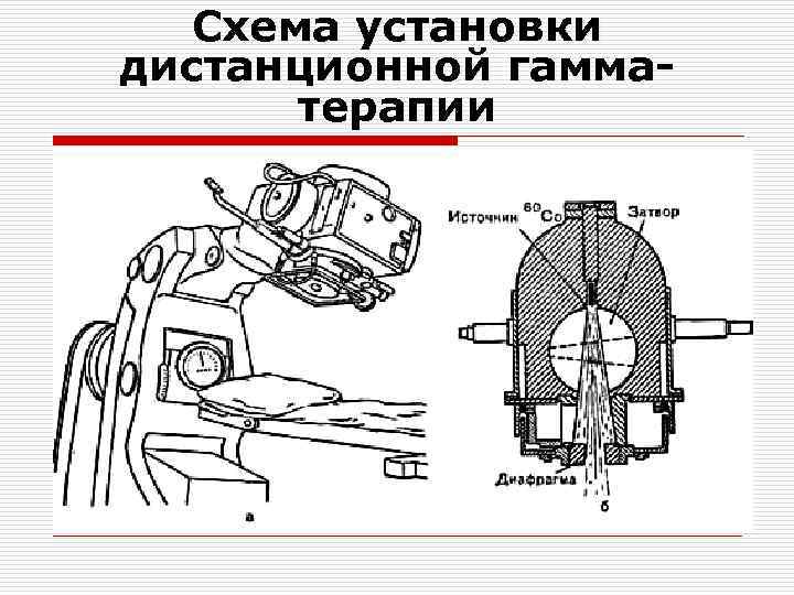 Схема установки дистанционной гамматерапии 