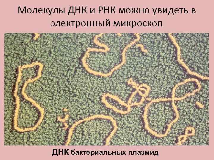 Молекулы ДНК и РНК можно увидеть в электронный микроскоп ДНК бактериальных плазмид 