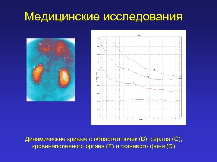 Медицинские исследования Динамические кривые с областей почек (B), сердца (C), кровенаполненого органа (F) и