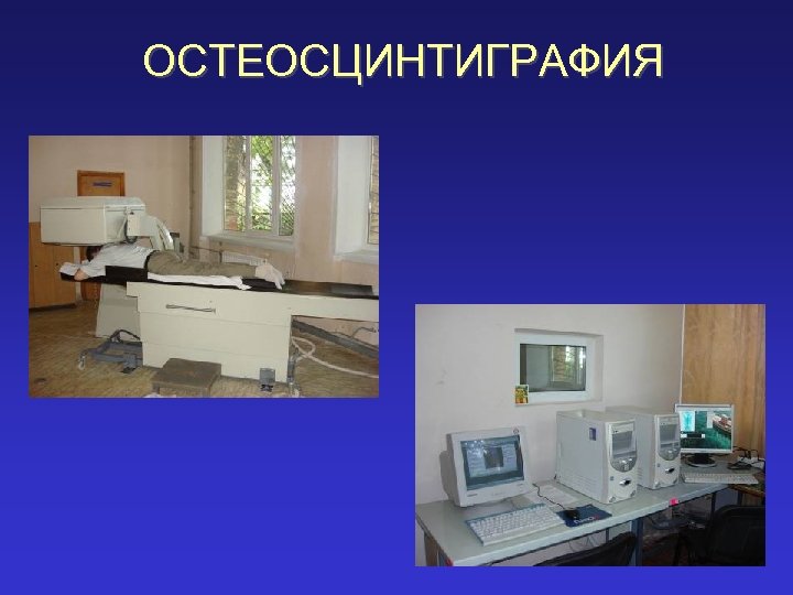 ОСТЕОСЦИНТИГРАФИЯ 