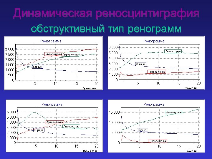 Динамическая реносцинтиграфия обструктивный тип ренограмм 