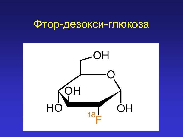 Фтор-дезокси-глюкоза 