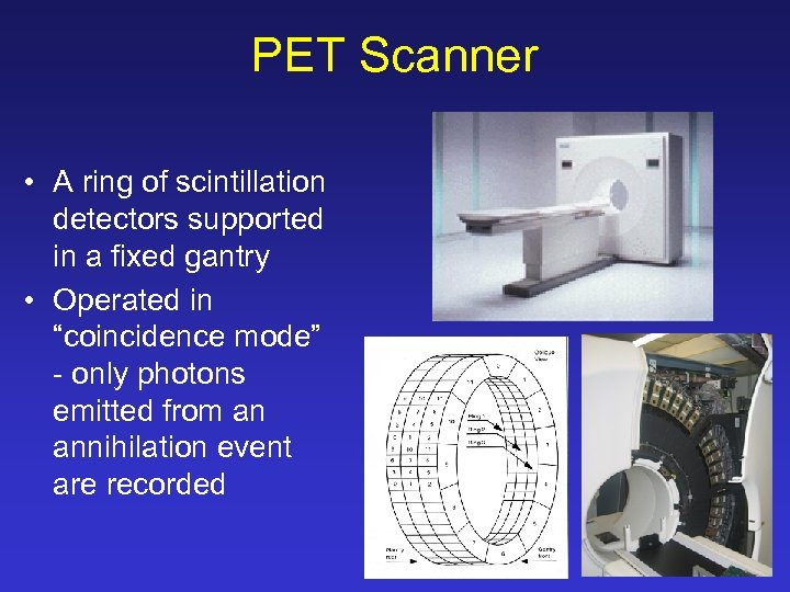 PET Scanner • A ring of scintillation detectors supported in a fixed gantry •