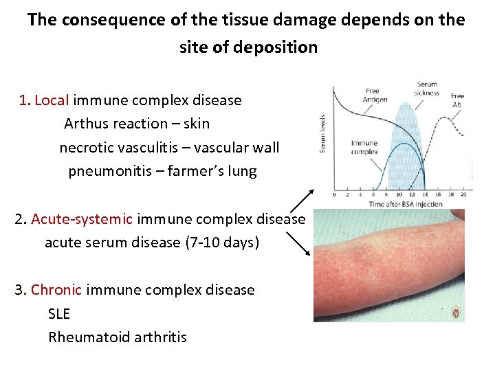 The consequence of the tissue damage depends on the site of deposition 1. Local