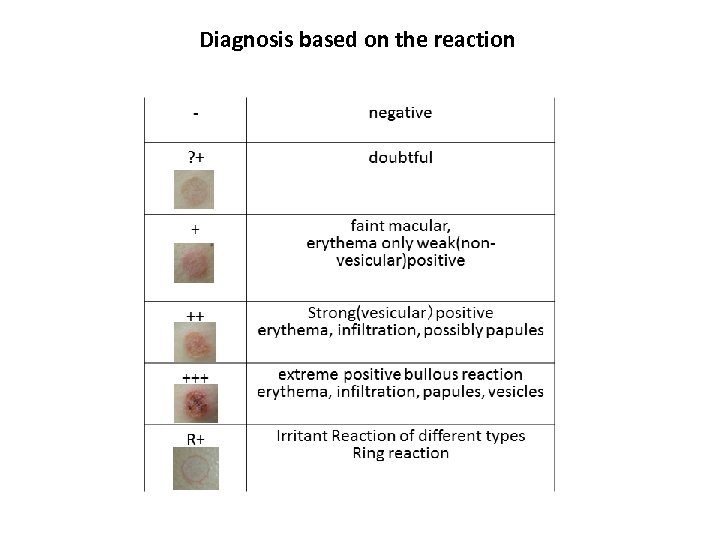 Diagnosis based on the reaction 