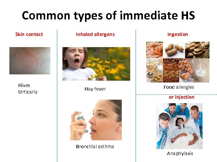 Common types of immediate HS Skin contact Inhaled allergens Ingestion Hives Urticaria Hay fever