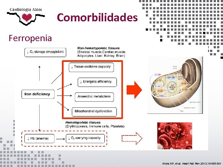 Comorbilidades Ferropenia Arora NP, et al. Heart Fail Rev 2013; 18: 485 -501 