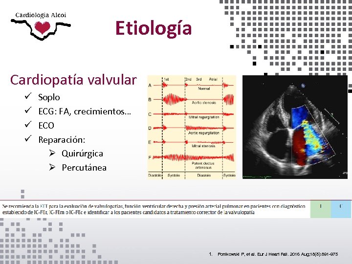 Etiología Cardiopatía valvular ü ü Soplo ECG: FA, crecimientos… ECO Reparación: Ø Quirúrgica Ø