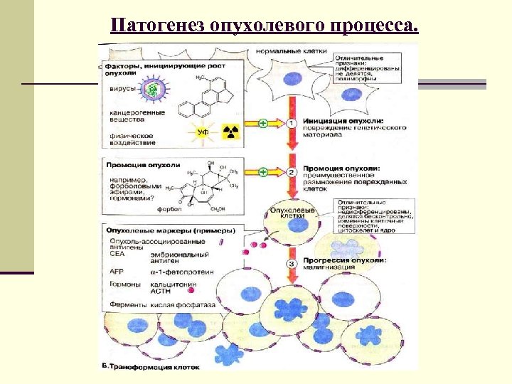 Неопластический процесс. Патогенез опухоли схема. Механизм развития опухоли патофизиология. Механизм развития опухолевого процесса. Механизмы опухолевой трансформации клеток.