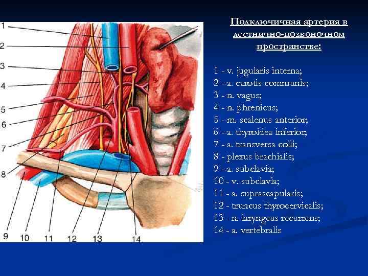 Подключичная артерия в лестнично-позвоночном пространстве: 1 - v. jugularis interna; 2 - a. carotis