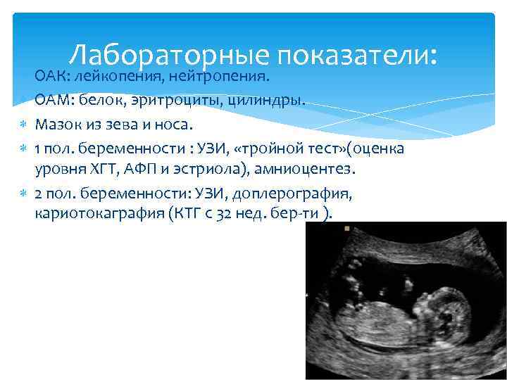 Лабораторные показатели: ОАК: лейкопения, нейтропения. ОАМ: белок, эритроциты, цилиндры. Мазок из зева и