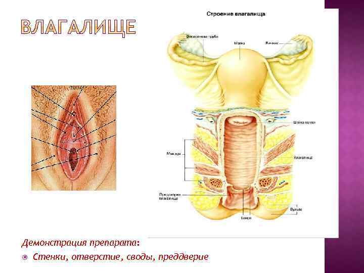 Демонстрация препарата: Стенки, отверстие, своды, преддверие 