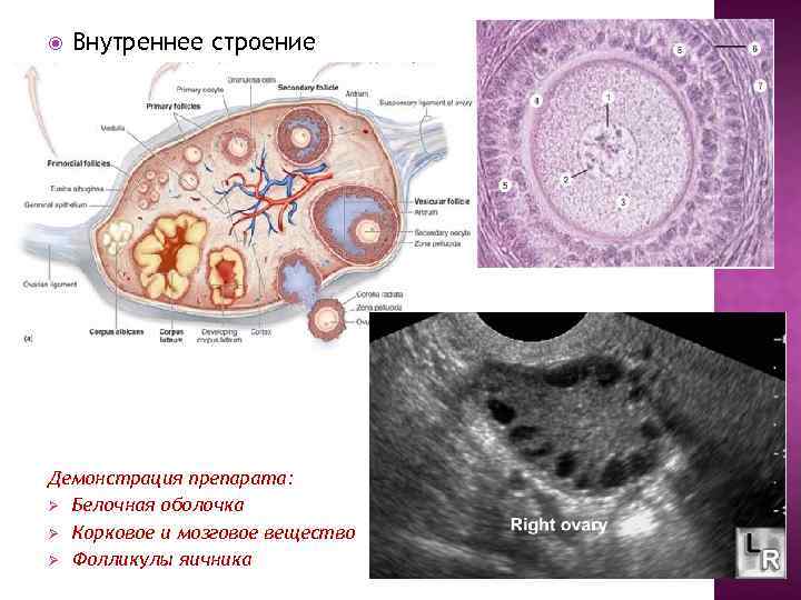 Строение яичника анатомия. Строение яичника. Строение яичника оболочки. Внутреннее строение яичника. Внутренний слой яичника.