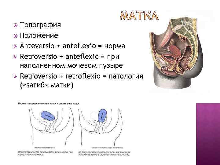 Топография Положение Ø Anteversio + anteflexio = норма Ø Retroversio + anteflexio = при